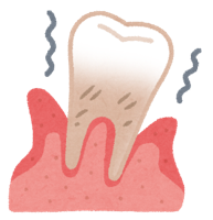 歯周病は、全身のあらゆる病気を悪化させる可能性も！